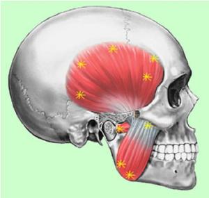 Dor orofacial e disfunção temporomandibular